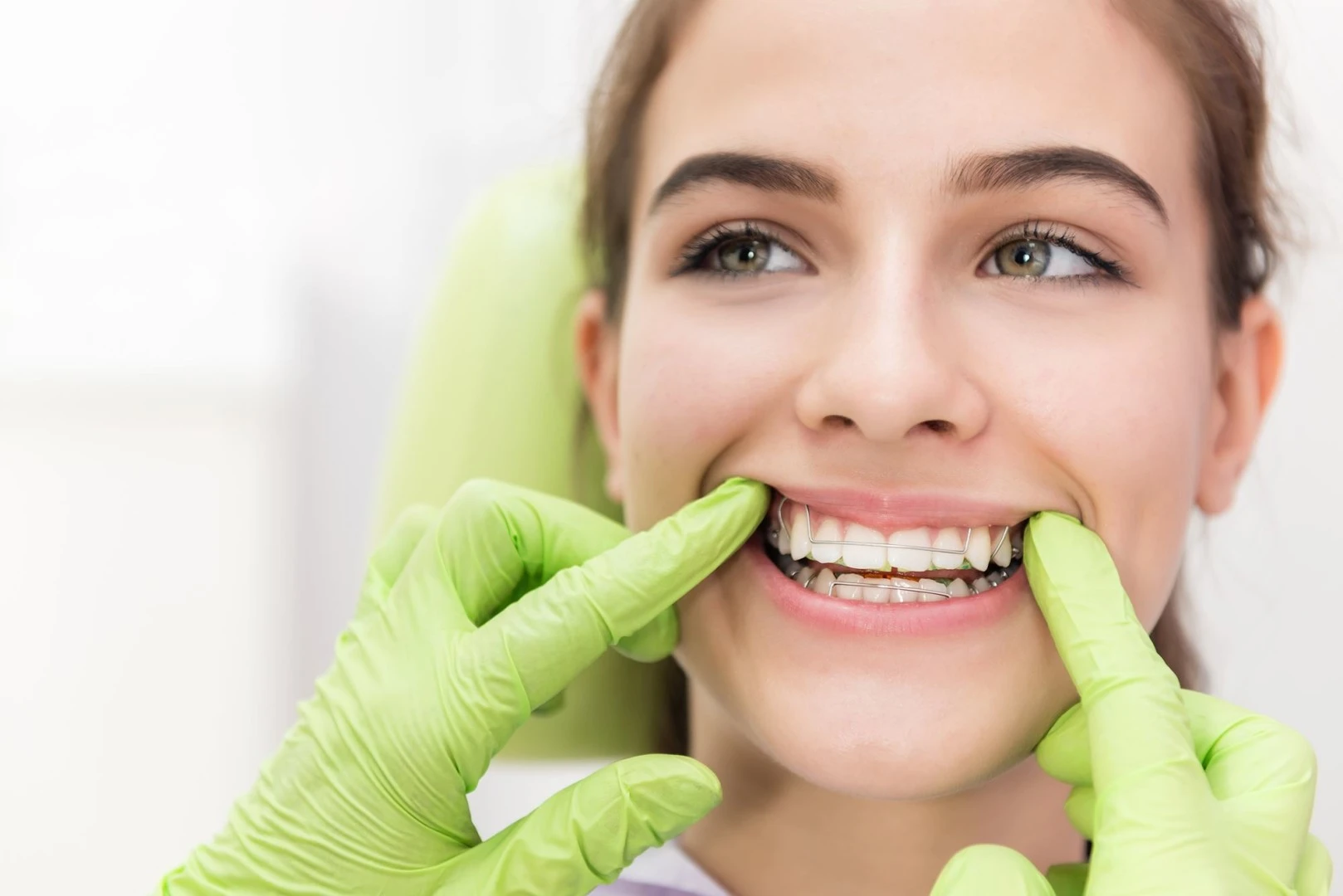 Orthodontie invisible -technique fils blancs