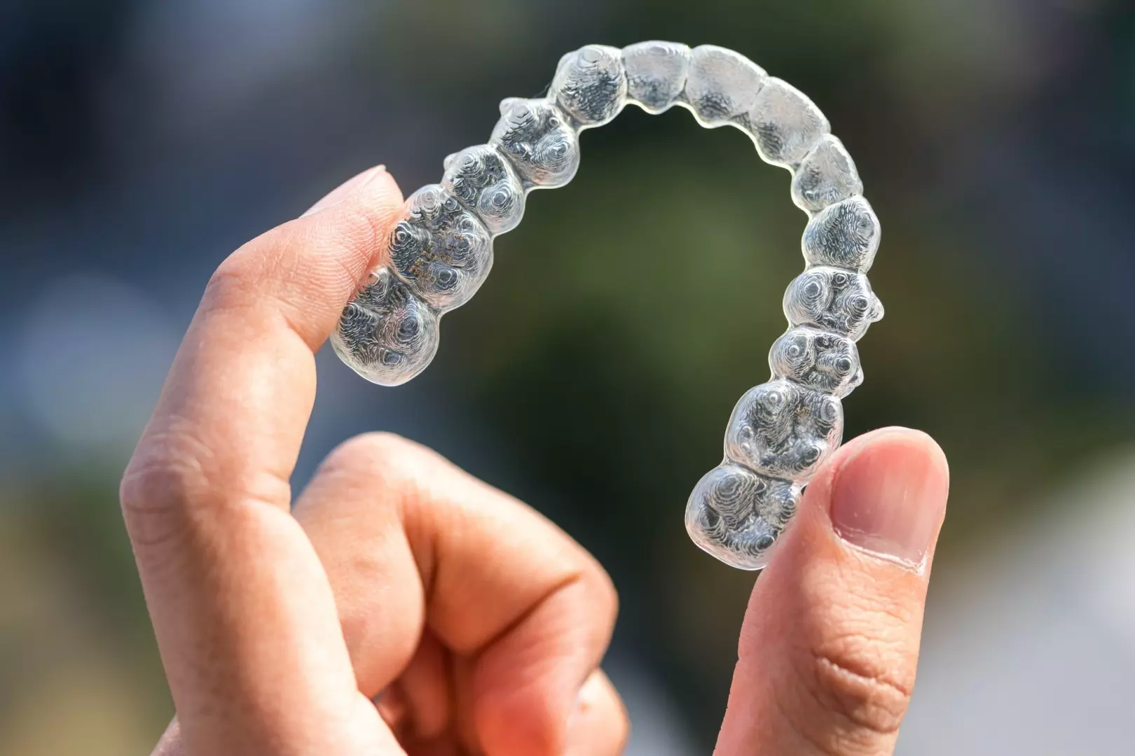 Orthodontie invisible -technique fils blancs